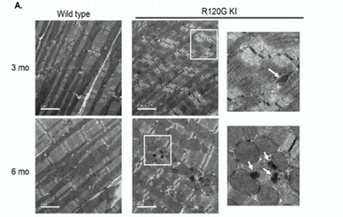 TEM of protein aggregation and mitochondrial function